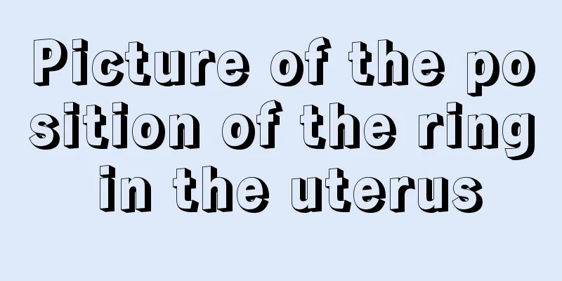 Picture of the position of the ring in the uterus