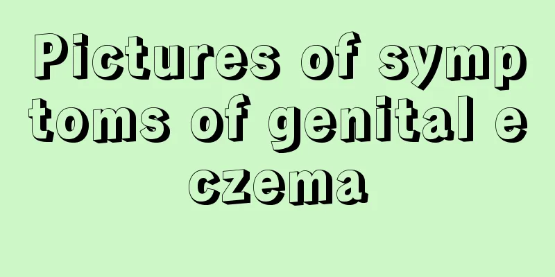 Pictures of symptoms of genital eczema