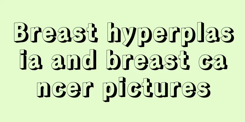 Breast hyperplasia and breast cancer pictures