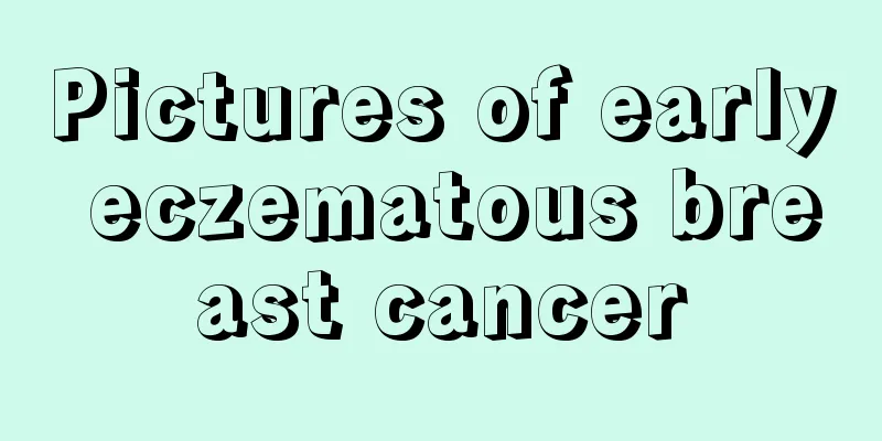 Pictures of early eczematous breast cancer