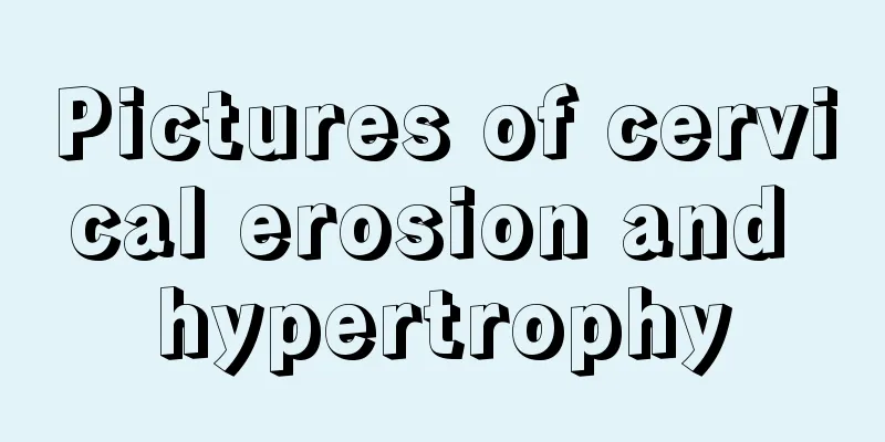 Pictures of cervical erosion and hypertrophy