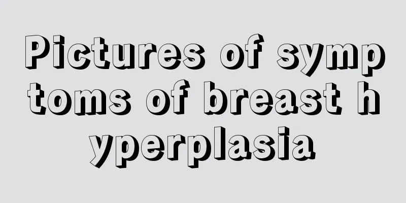 Pictures of symptoms of breast hyperplasia