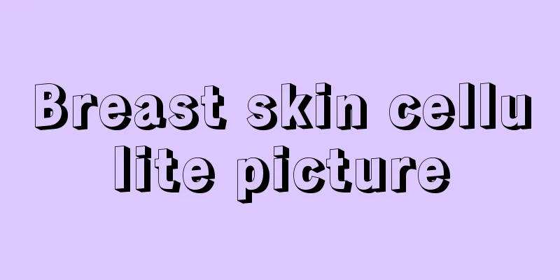 Breast skin cellulite picture