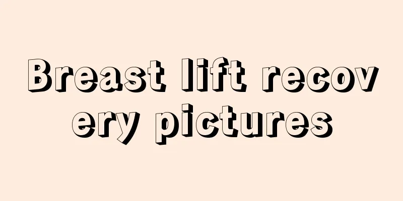 Breast lift recovery pictures