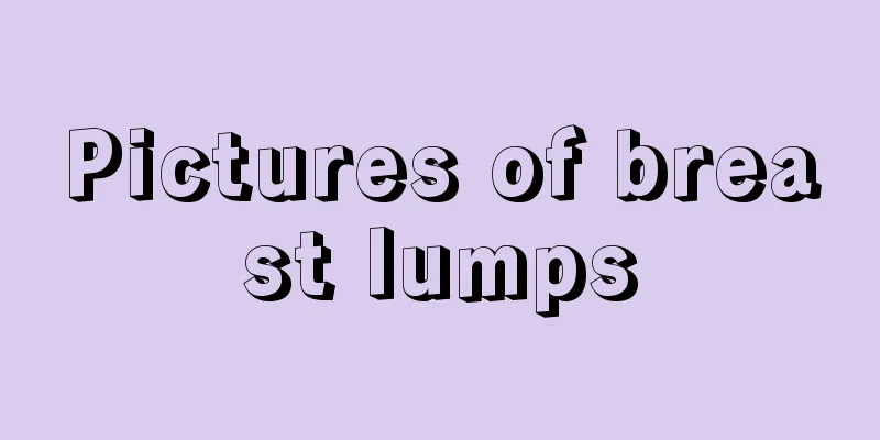 Pictures of breast lumps