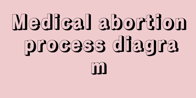 Medical abortion process diagram