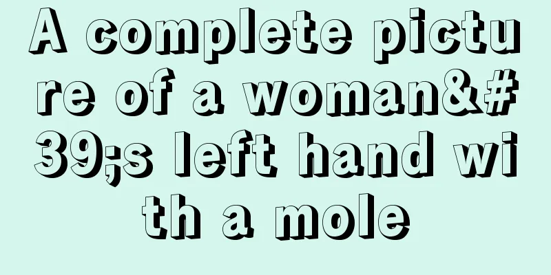 A complete picture of a woman's left hand with a mole