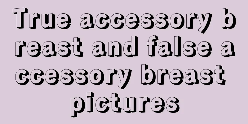 True accessory breast and false accessory breast pictures