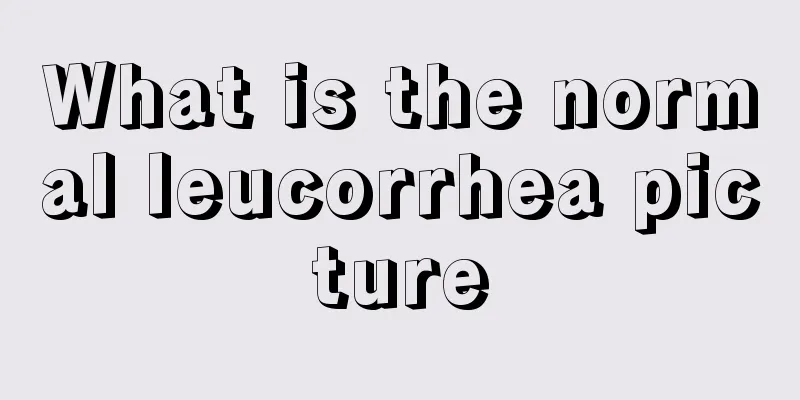 What is the normal leucorrhea picture