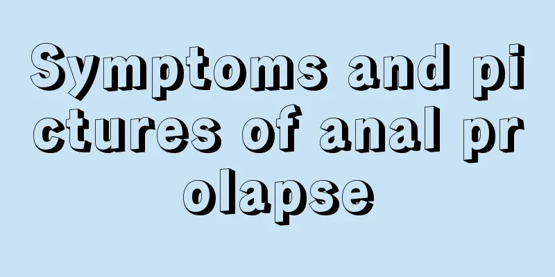 Symptoms and pictures of anal prolapse