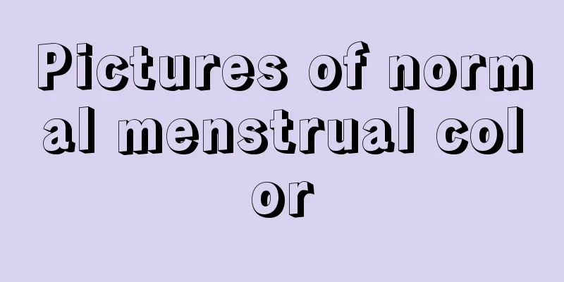 Pictures of normal menstrual color