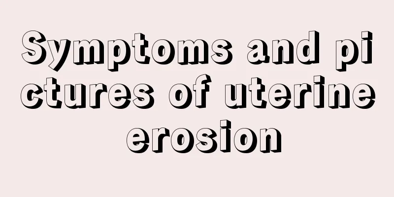 Symptoms and pictures of uterine erosion