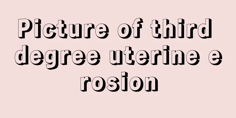 Picture of third degree uterine erosion