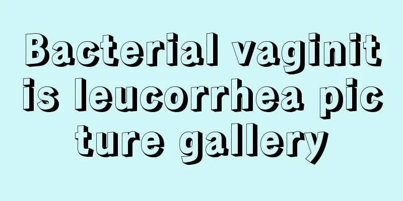 Bacterial vaginitis leucorrhea picture gallery