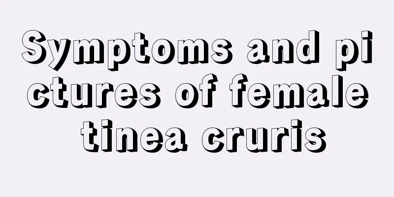 Symptoms and pictures of female tinea cruris