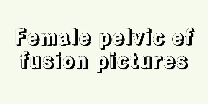 Female pelvic effusion pictures