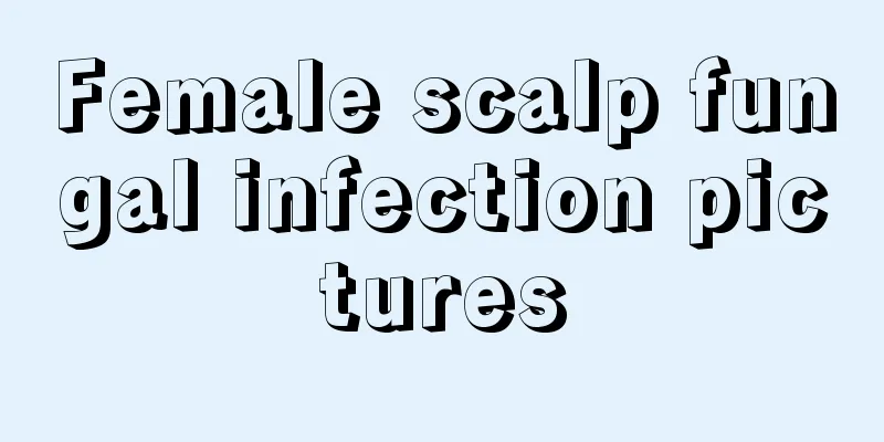 Female scalp fungal infection pictures