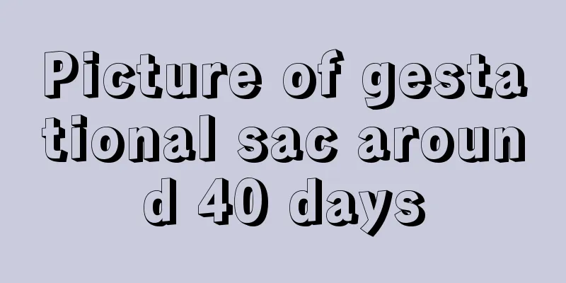 Picture of gestational sac around 40 days