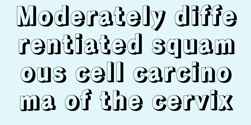 Moderately differentiated squamous cell carcinoma of the cervix