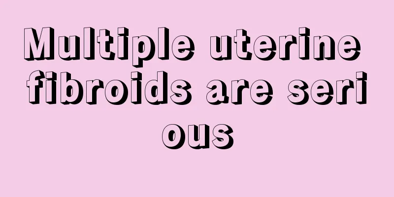 Multiple uterine fibroids are serious