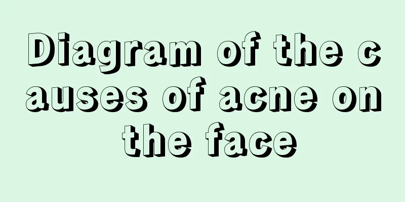 Diagram of the causes of acne on the face