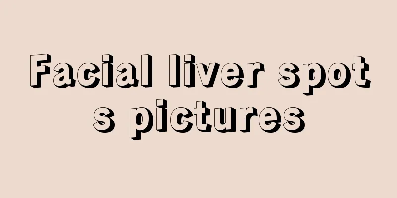 Facial liver spots pictures