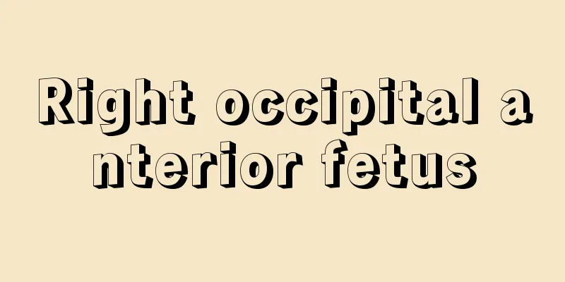 Right occipital anterior fetus