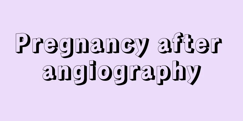 Pregnancy after angiography