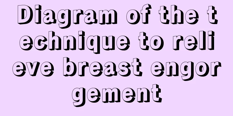 Diagram of the technique to relieve breast engorgement