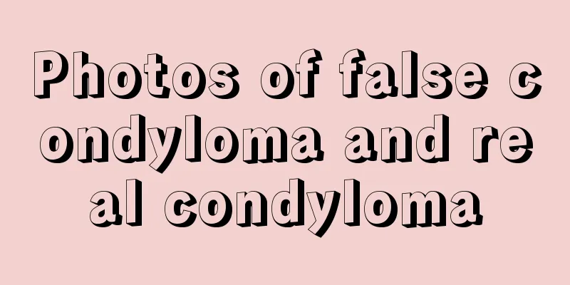 Photos of false condyloma and real condyloma