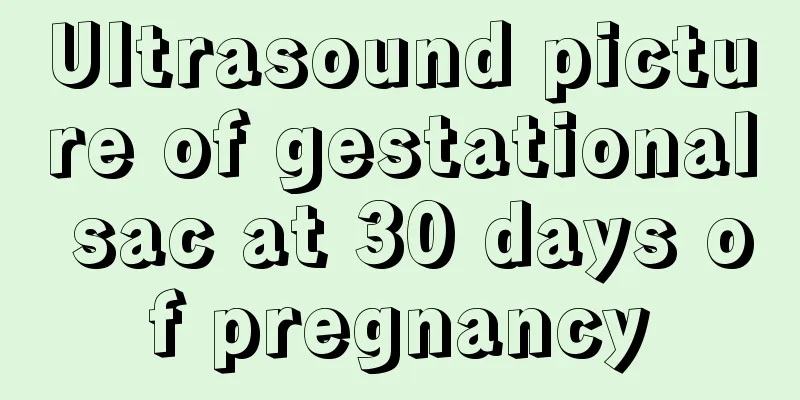 Ultrasound picture of gestational sac at 30 days of pregnancy