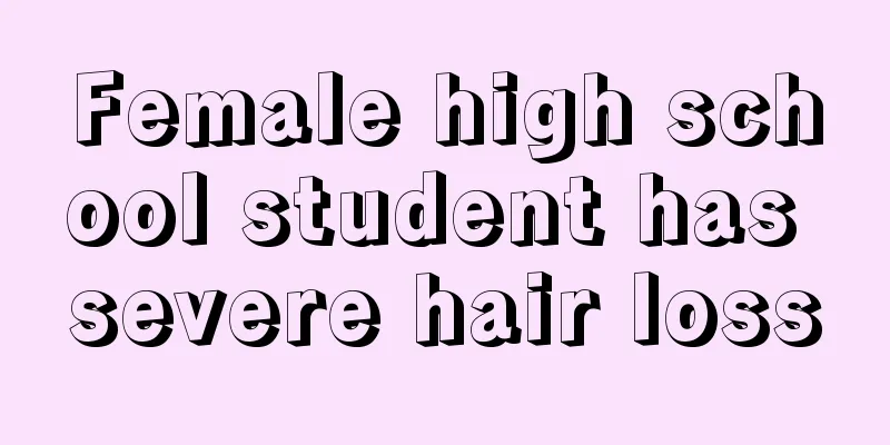 Female high school student has severe hair loss