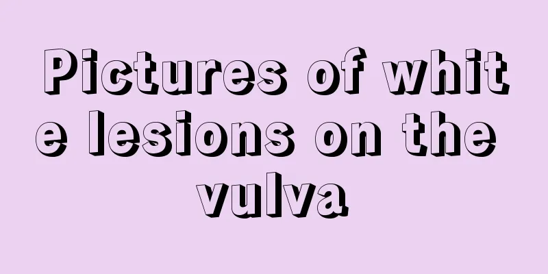 Pictures of white lesions on the vulva