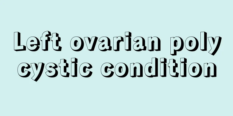 Left ovarian polycystic condition