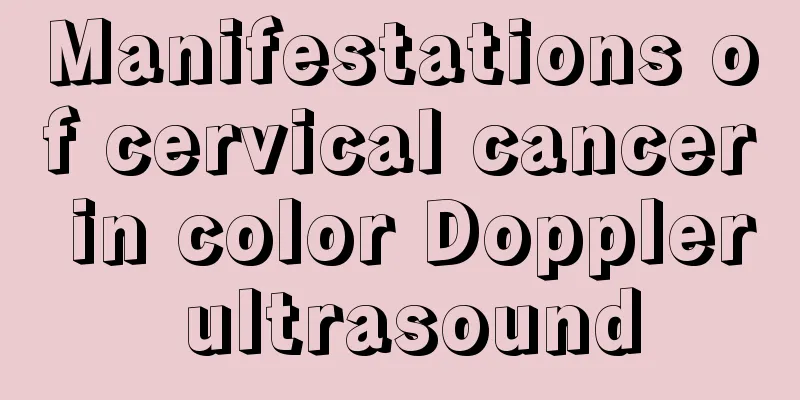 Manifestations of cervical cancer in color Doppler ultrasound