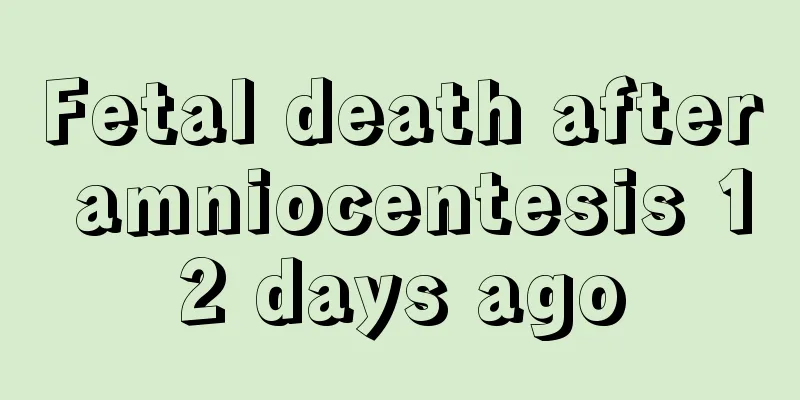 Fetal death after amniocentesis 12 days ago