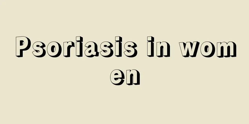 Psoriasis in women