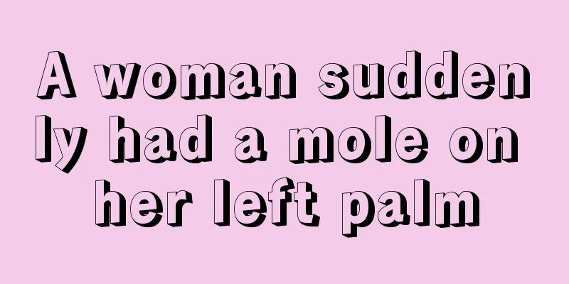 A woman suddenly had a mole on her left palm