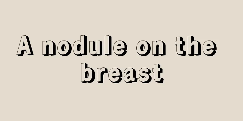 A nodule on the breast