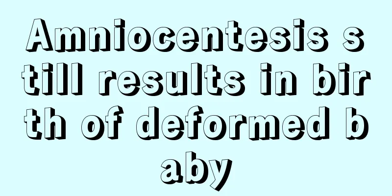 Amniocentesis still results in birth of deformed baby