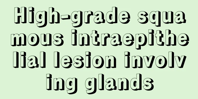 High-grade squamous intraepithelial lesion involving glands