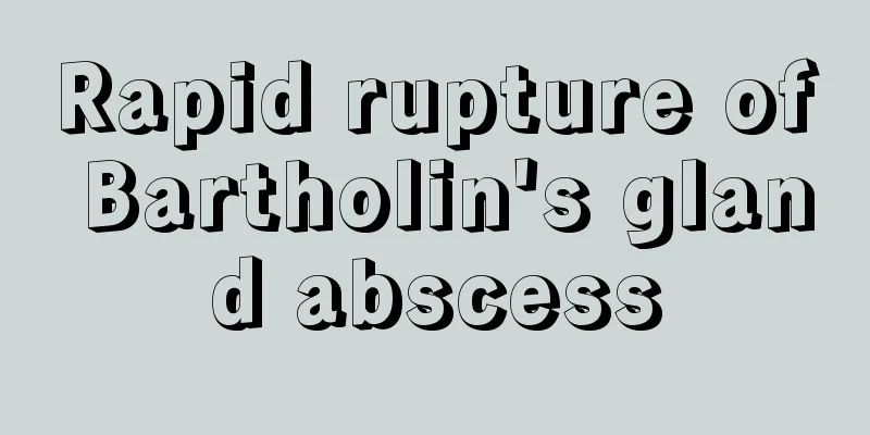 Rapid rupture of Bartholin's gland abscess