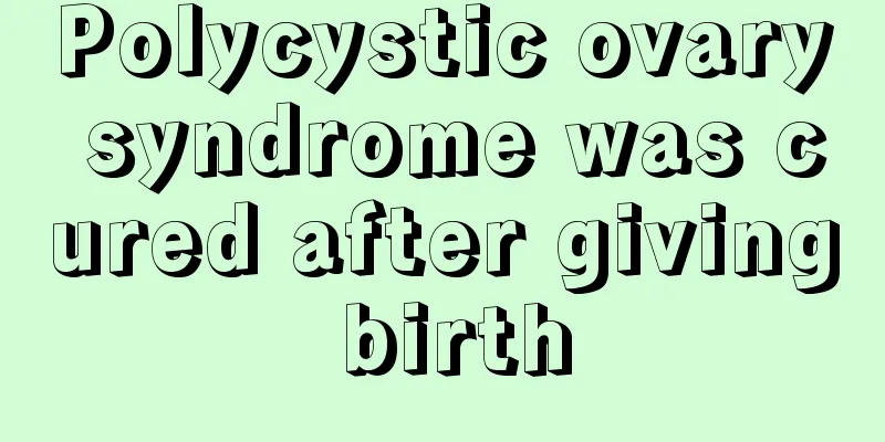 Polycystic ovary syndrome was cured after giving birth