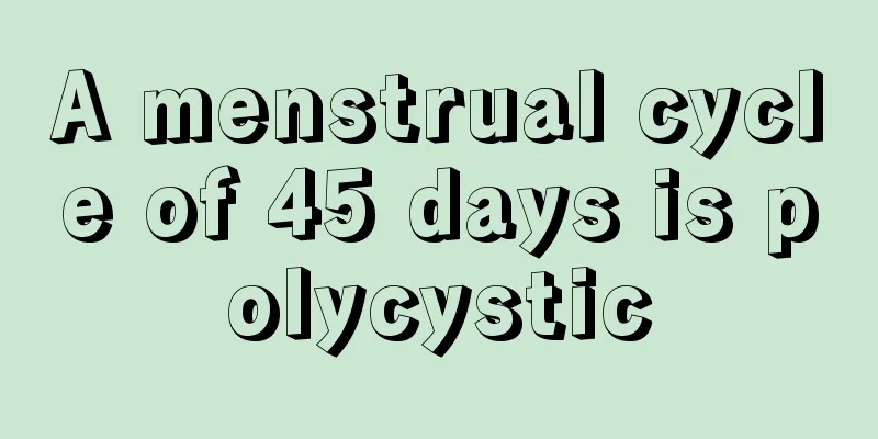 A menstrual cycle of 45 days is polycystic