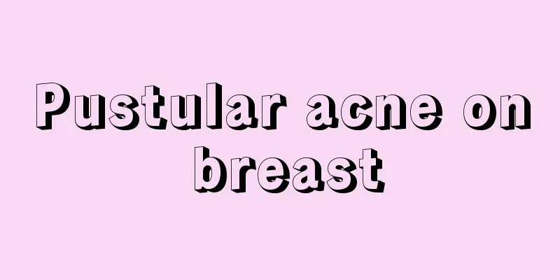 Pustular acne on breast