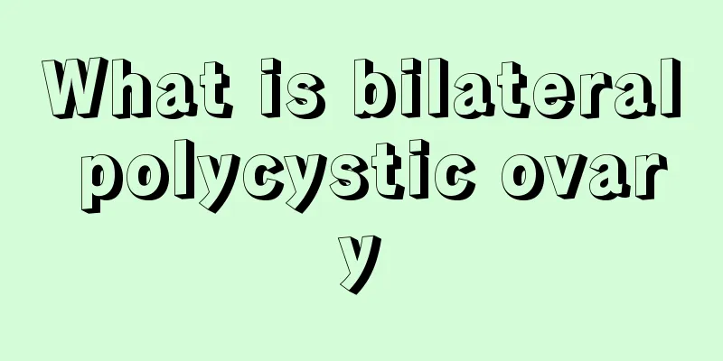 What is bilateral polycystic ovary