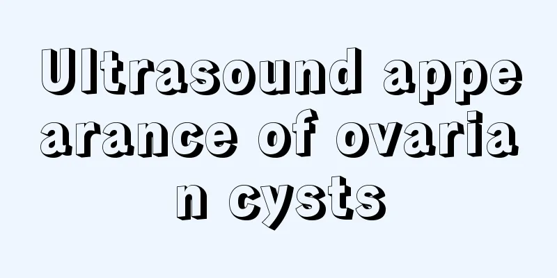 Ultrasound appearance of ovarian cysts