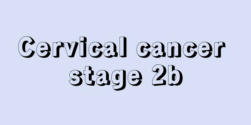 Cervical cancer stage 2b