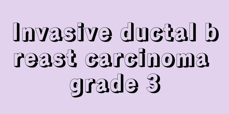 Invasive ductal breast carcinoma grade 3