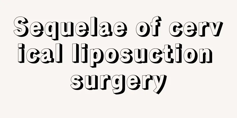 Sequelae of cervical liposuction surgery